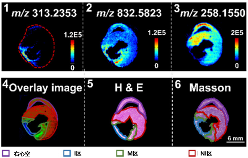 中西药治疗心衰的代谢转录组学研究：芪参益气滴丸的协同机制解析 onerror=