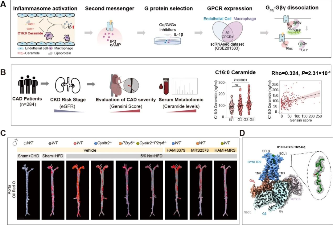 真相来了！导致动脉硬化的主要元凶不是高血脂，他汀可以停药吗？ onerror=