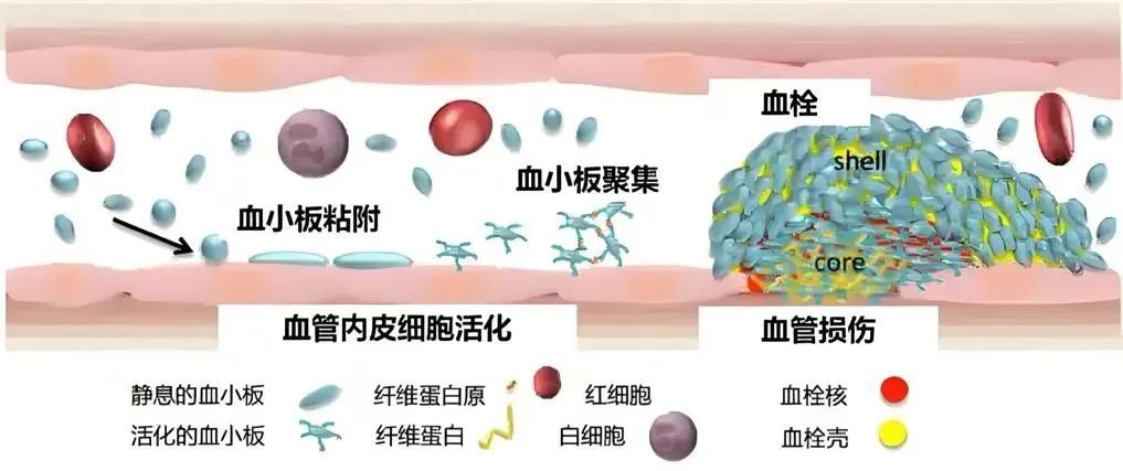 一文读懂：阿司匹林、吲哚布芬、氯吡格雷......抗血小板药物区别 onerror=
