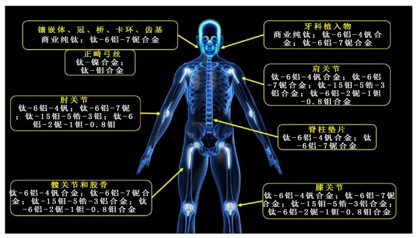 骨科钢钉、牙科种植体、心脏支架……钛合金为何不被人体所排斥？ onerror=