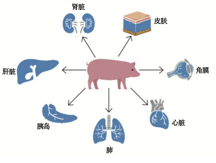 全球首例！除了心、肝、肾，猪的这个器官也成功移植给人 onerror=